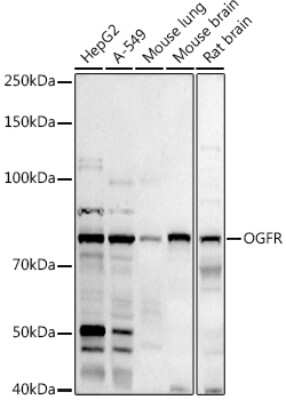 Western Blot: Zeta Opioid Receptor Antibody [NBP2-94528] - Western blot analysis of extracts of various cell lines, using (NBP2-94528) at 1:1000 dilution. Secondary antibody: HRP Goat Anti-Rabbit IgG (H+L) at 1:10000 dilution. Lysates/proteins: 25ug per lane. Blocking buffer: 3% nonfat dry milk in TBST. Detection: ECL Basic Kit. Exposure time: 180s.